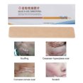 thumbnail image 3 of Parche para eliminar marcas de heridas hoja de cicatriz de silicona ligera autoadhesiva portátil para cualquier tipo de piel ANGGREK Otros, 3 of 8