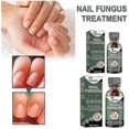 thumbnail image 3 of ExquisiteEffective Nail Fungus Treatment for Stronger Nails - Stop Fungal Growth, Repair and Renew, 3 of 5