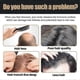 thumbnail image 5 of 1/3/5x Spartan Shampoo, Spartan Root Activator Shampoo, Mane Root Activator Shampoo, 5 of 5