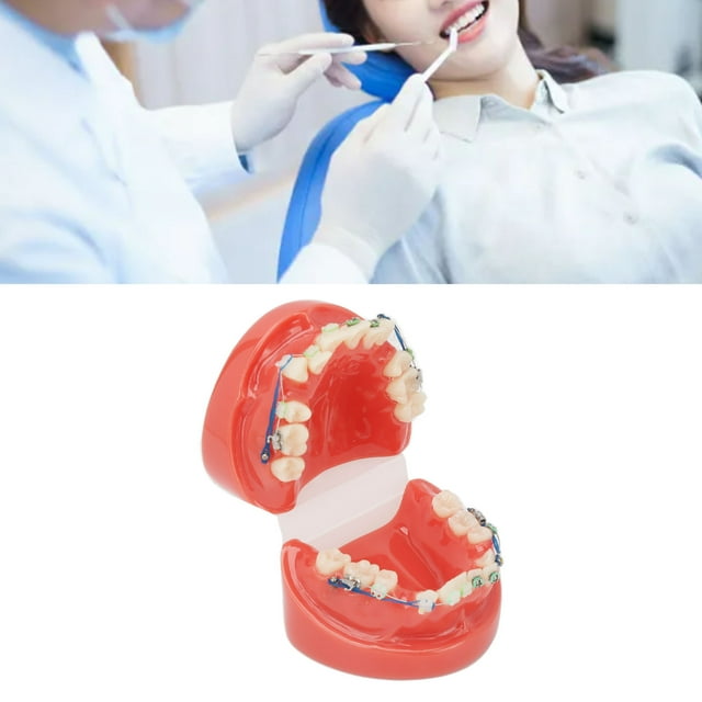 Model, Metal Wires Teeth Model 24 Teeth Orthodontics Resin for Students for Clinics