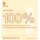 thumbnail image 4 of Bio-Oil, Aceite Corporal, Disminuye Cicatrices y Estrías, Skincare Oíl, 200 ml, 4 of 7