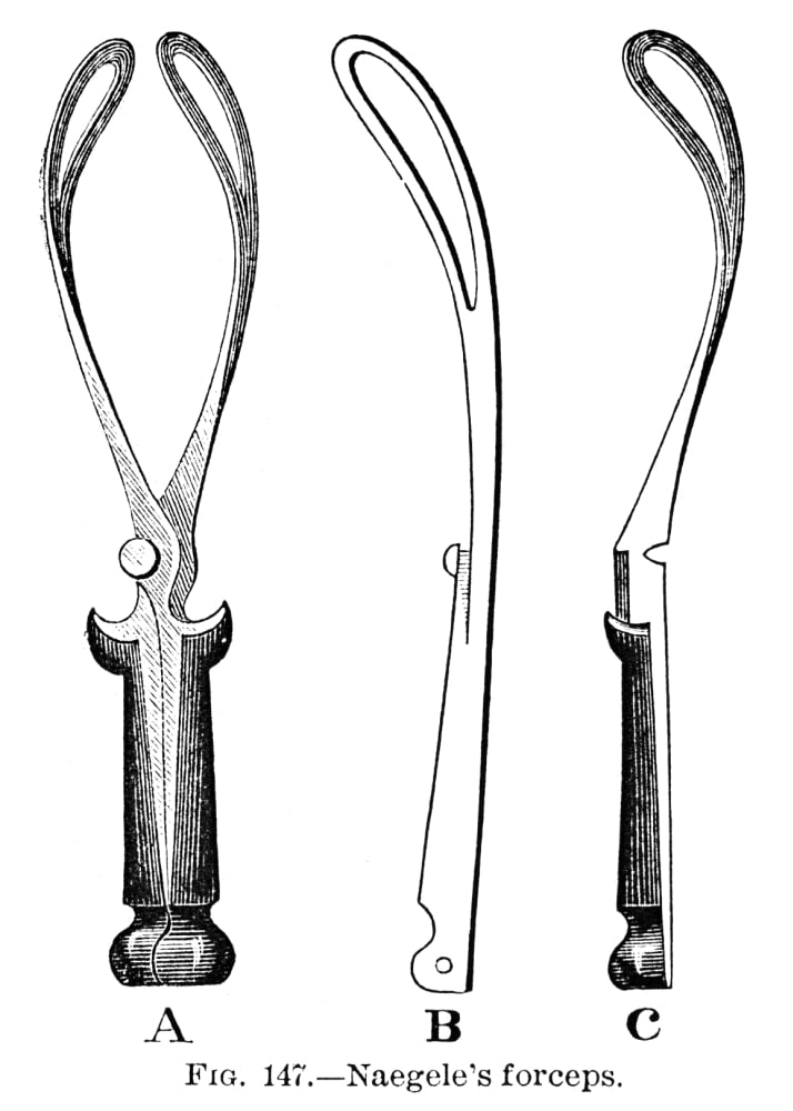Childbirth Forceps C1880 Na Diagram Of NaegeleS Forceps Used In