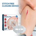 thumbnail image 1 of 5pcs Wound Closure Strip, Stitch Free Closure Device, Zip and Stitch Suture-Free, Adhesive Stitch Close Wound Device, Flexible Fabric Adhesive Bandage, 1 of 5