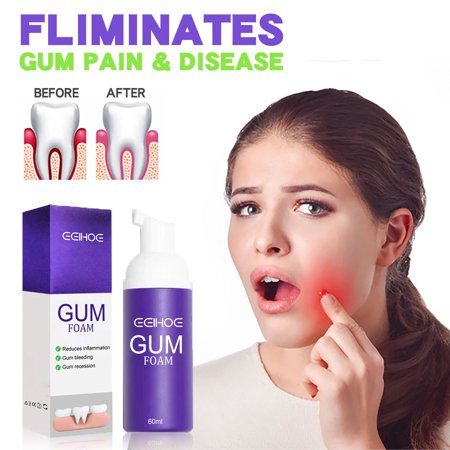 EELHOE Gum Foam Mousse, Caring for Deep Dirt on the GumsTeeth Cleaning Teeth Mousse Toothpaste