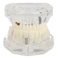 thumbnail image 2 of Modelo de dientes de laboratorios dentales, estudio dental Dientes transparentes Modelo de dientes de aprendizaje Modelo de dientes transparentes Rendimiento de alta gama, 2 of 8