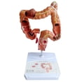 thumbnail image 1 of Teaching Model,Human Large Intestine Anatomy Model Visceral Lesion Model Human Digestive System Learning Model, 1 of 6