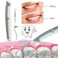 thumbnail image 3 of Limpiador de dientes eléctrico YONGSHENG Ultrasónico, 3 of 5