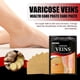 thumbnail image 5 of El parche para la salud de las venas alivia el bloqueo de los vasos sanguíneos varicosos en los pies, el parche para la salud de las venas con compresa fría Afortunado Sencillez, 5 of 5