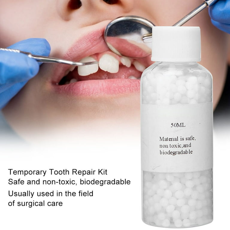 30 g Tooth Repair Kit, Temporary Teeth Replacement Kit - Moldable Ther –  TweezerCo