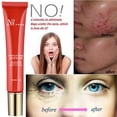 thumbnail image 1 of Outils de Beauté Doux - Extrait Anti-Rides Marques Visage 20g, 1 of 9