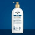 Gold Bond Healing Hydrating Lotion, 14 oz., With Aloe, Moisturizes