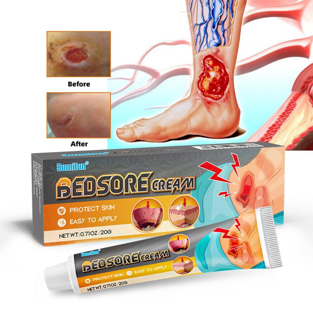 20g Bed Sore Cream Bedsore Ointment Bed Sores Treatment Wound Healing Gel M9P8