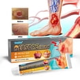 thumbnail image 2 of 20g Bedsore Care Cream, Necrosis Dressing Skin Care Ointment, 2 of 8
