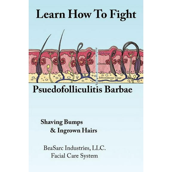 Learn How to Fight Psuedofolliculitis Barbae : Shaving Bumps & Ingrown Hairs