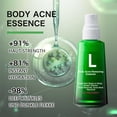 thumbnail image 4 of BUY 2 SAVE 10%!Maojin Acné Corporal, Para Eliminar Acné, Espinillas Y Acantosis Nigricans, Acné Corporal Para El Cuerpo, Peeling De Acné Para Espalda Y Glúteos Etc 30ml, 4 of 8