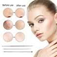 thumbnail image 4 of 18 PCS Blackhead Remover, Pimple Popper Tool Kit Acne Removal Kit for Blemish, Whitehead Popping, Zit Removing for Nose Face Tools with a Leather Bag, Silver, 4 of 5