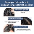 thumbnail image 3 of Exfoliante para el cuero cabelludo Eelhoe, hidratante, refrescante, para el cuidado del cuero cabelludo y el cabello seco, 1 unidad, 3 of 5