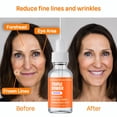 thumbnail image 4 of Serum IQ Natural Argireline & Matrixyl 3000 30 ml antienvejecimiento, 4 of 7