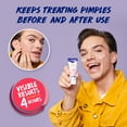 thumbnail image 6 of Clearasil Benzoyl Peroxide Rapid Rescue Spot Treatment Acne Cream, 1 fl oz, 6 of 12