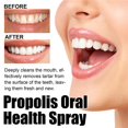 thumbnail image 3 of Propolis Oral Health Spray, Propolis Oral Spray, Fresh Breath, 3 of 4