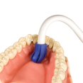 thumbnail image 3 of Blue Tip Total-Comfort Aspiradores De Punta Blanda Eyectores De Saliva Desechables Tubo Blanco Paquete De 100, 3 of 5