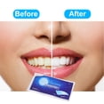 thumbnail image 2 of Tiras para blanquear los dientes, 7 Uds., blanqueador de dientes, elimina el café, el té y TFixol Natural, 2 of 5