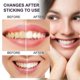 thumbnail image 4 of Paquete de 3 pastas de dientes embellecedoras de dientes morados Eelhoe con niacinamida que blanquean los dientes amarillos y eliminan las manchas -4388945502190, 4 of 4