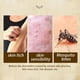 thumbnail image 5 of Fiudx Liquidación de ahorros de verano Crema antipicazón, crema a base de hierbas para la psoriasis, dermatitis alérgica y eczema, 5 of 6