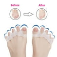 Toe Separators for Overlapping Toes MICPANG Correct Bunions and Restore