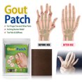 thumbnail image 1 of Gout Patch, Relieve Finger Toe Joint Cervical Vertebra Lumbar Pain Bunion Care Patch, 1 of 5