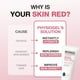 thumbnail image 4 of Crema Facial Physiogel Calmante Relieve Rojo con Ceramida para Piel Sensible y Seca, 4 of 7