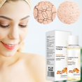 thumbnail image 2 of Tónico facial de cúrcuma para mejorar el cutis facial Bueno para mujeres Hombres UseL, 2 of 5