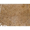 thumbnail image 2 of Josh's Frogs Coco Fiber Mat (~12 x 12 inch), 2 of 5