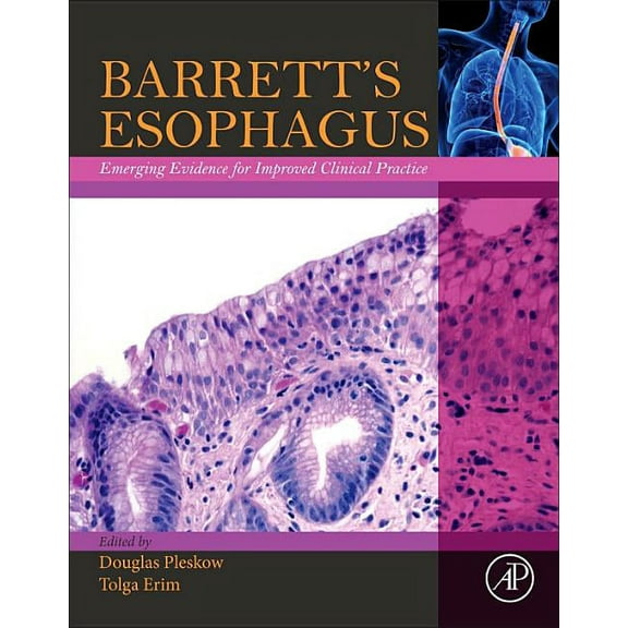 Barrett's Esophagus: Emerging Evidence for Improved Clinical Practice, (Paperback)