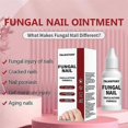 thumbnail image 2 of 15ml Fungi Nail Treatment Liquid Fast-acting Nail Repair Strengthening Liquid Nails Care Supplies, 2 of 5