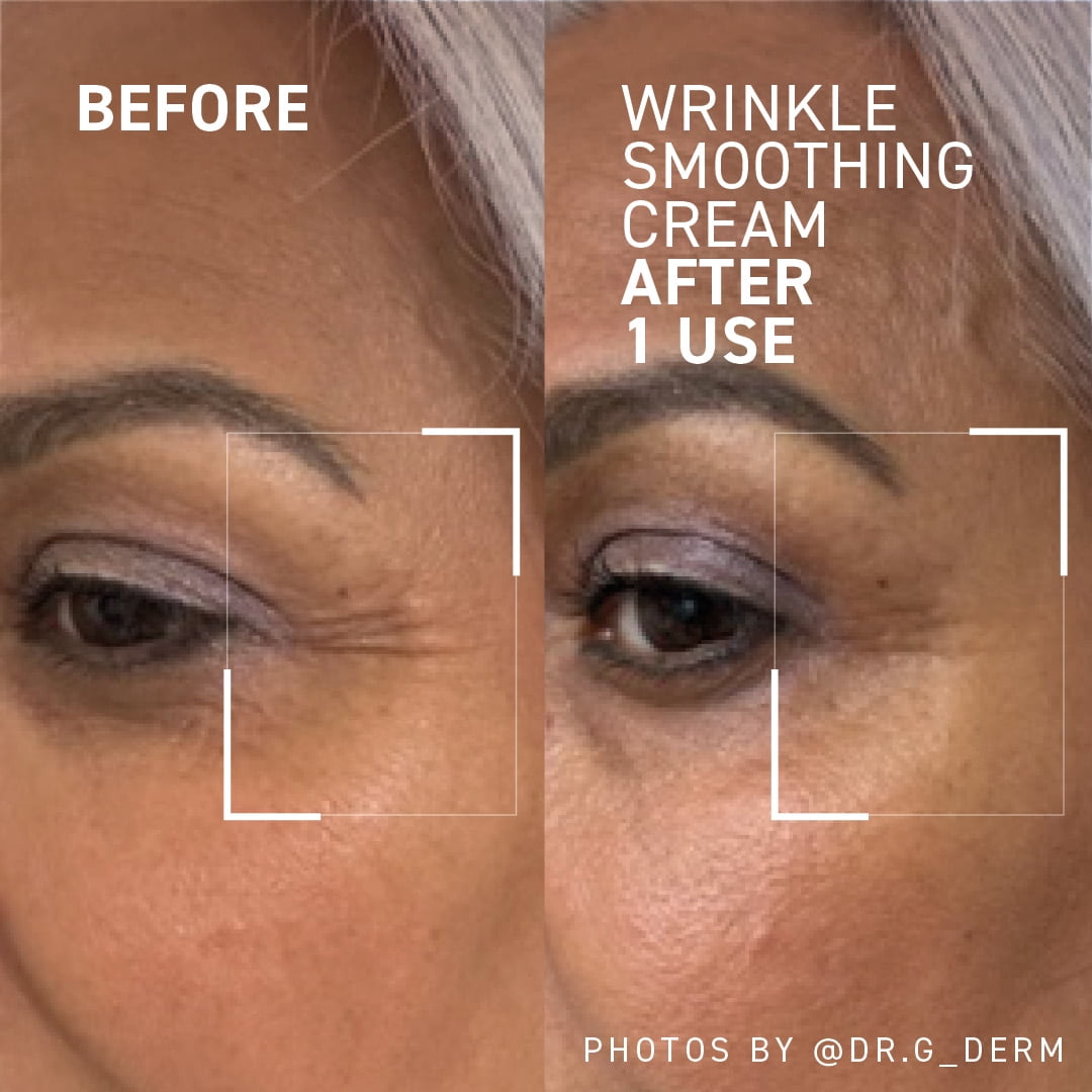 Dr. Brandt Skincare Needles No More® Wrinkle Smoothing Cream