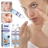 Ktyne Preservative Sterile Saline Solution Replacement - Contact Solution For Cleaning, Rinsing And Storing Soft . 2x15ml