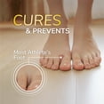 thumbnail image 4 of Dr. Scholl’s Odor-X Athlete's Foot Antifungal Cream 24 Hour Itch & Burn Relief, 4 of 11