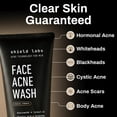 thumbnail image 4 of Kit Shield Acne System de 3 pasos con peróxido de benzoilo al 4%, 4 of 9