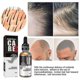 thumbnail image 4 of South Moon Antifalling Conditioner Essential Oil Moisturizes Hair Roots, 4 of 4