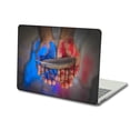 thumbnail image 5 of KSK KAISHEK Hard Case Shell Cover Compatible with MacBook Pro 14 inchs 2023 2022 2021 A2779 M2 & A2442 M1, Feather Series 0162, 5 of 5