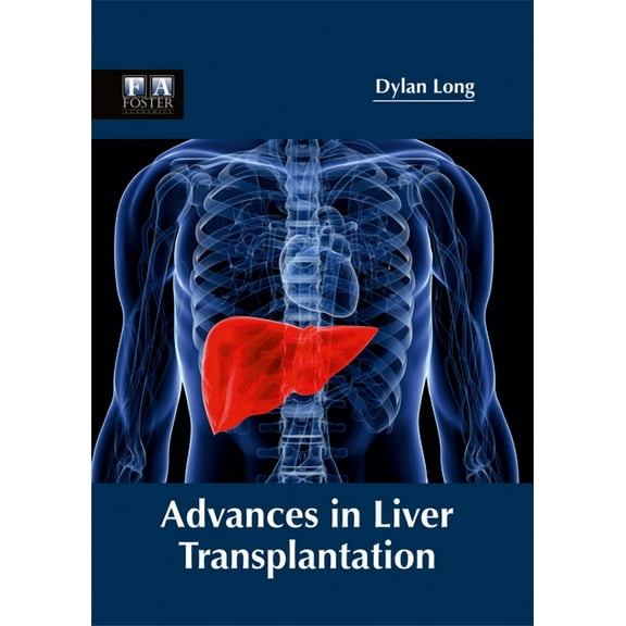 Advances in Liver Transplantation, (Hardcover)