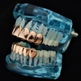 thumbnail image 5 of 14K Rose Gold Plated Grillz Set Upper Top And Bottom Lower Plain Teeth Hip Hop Grills, 5 of 5