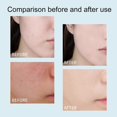 thumbnail image 3 of Wash Free Facial Cleanser Moisturizing 30ml for All Skin Types Men Women, 3 of 5