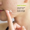 thumbnail image 4 of Crema facial hidratante SVR Sebiaclear con niacinamida 40 ml, 4 of 6