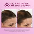 thumbnail image 4 of BosleyMD Women's Regrowth Treatment 2% Minoxidil Spray, 4 of 9