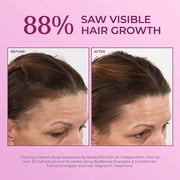 BosleyMD Womens Regrowth Treatment 2% Minoxidil Spray