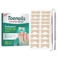 thumbnail image 2 of Professional Toenail Correction Sticker Kit, 50 Pcs Breathable Ingrown Toenail Corrector Strips with 2 Pedicure Manicure Tools for Foot Care, 2 of 9