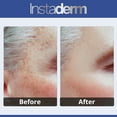 thumbnail image 3 of Anti Aging Corrector Cream- Naturally Fades Sun Spots, Age Spots, Acne Blemish Scars, Brown Spots & Freckles for Brighter Lighter Hydrated Looking Skin., 3 of 5