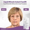 thumbnail image 4 of Sérum para ojos Beverly Hills Instant Facelift Antienvejecimiento 30 ml, 4 of 8